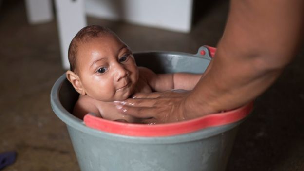 Canada to conduct world’s first Zika vaccine test on humans